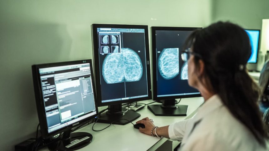 Jornadas de concientización sobre el cáncer de mama